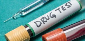 Drug testing Ketamine and Bladder Damage at MDC
