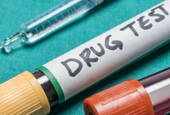Drug testing Ketamine and Bladder Damage at MDC