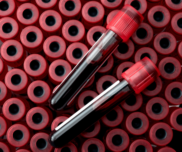 Blood Test and it's Benefits Marylebone Diagnostic Centre