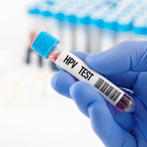 HPV Test