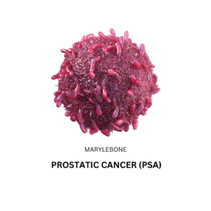 Prostate Specific Antigen PSA Screening at Marylebone Lab in London