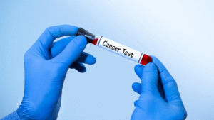 Book Your Cancer Marker Blood Test in London Today!