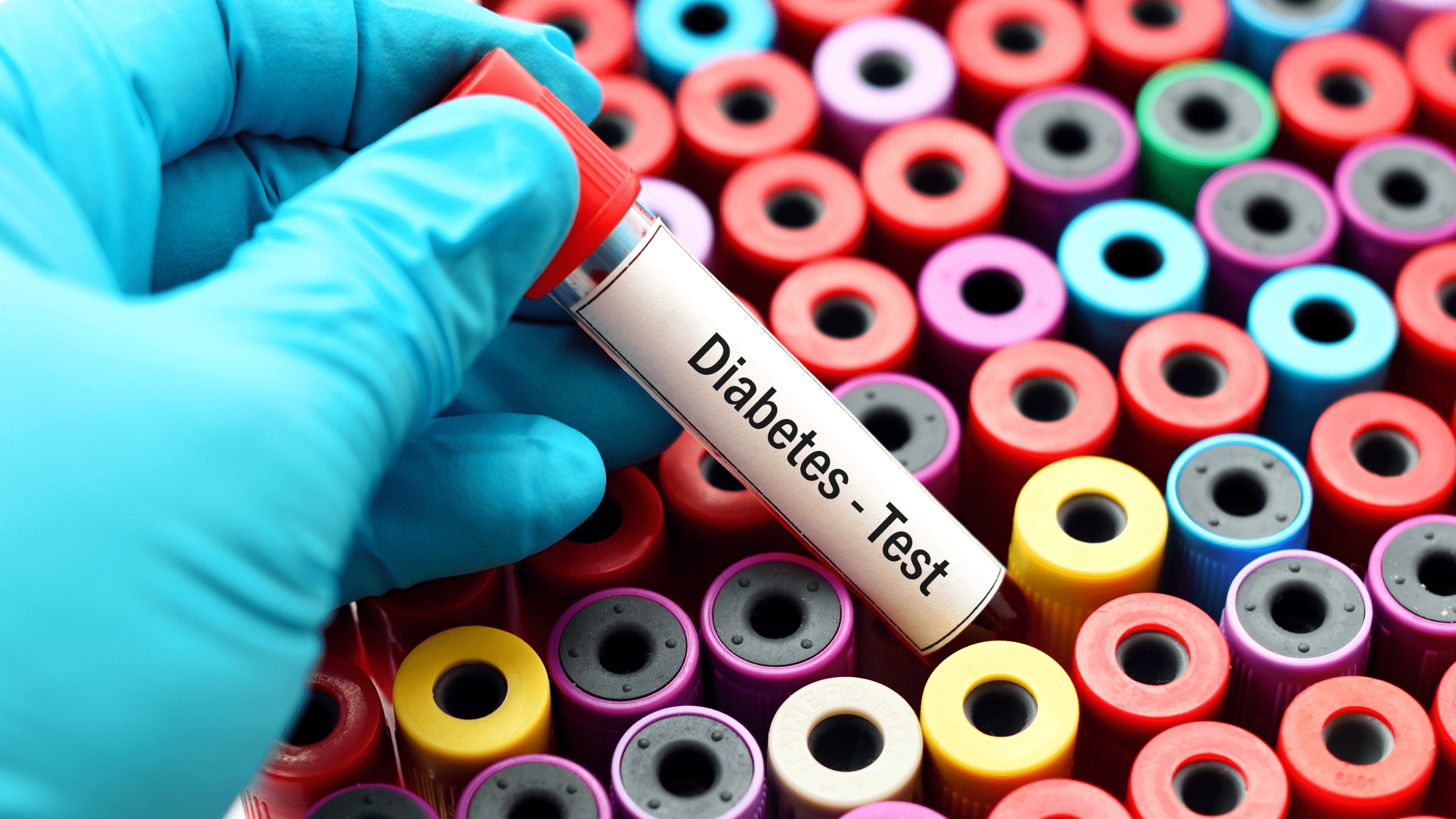 Mounjaro, Retatrutide, and Type 2 Diabetes: Why Monitoring Matters