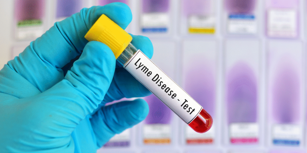 Advanced Sexual Health Panel or Lyme Disease Test