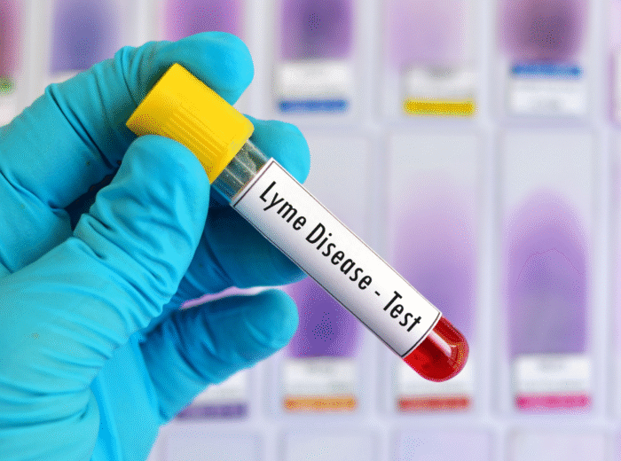 Advanced Sexual Health Panel or Lyme Disease Test