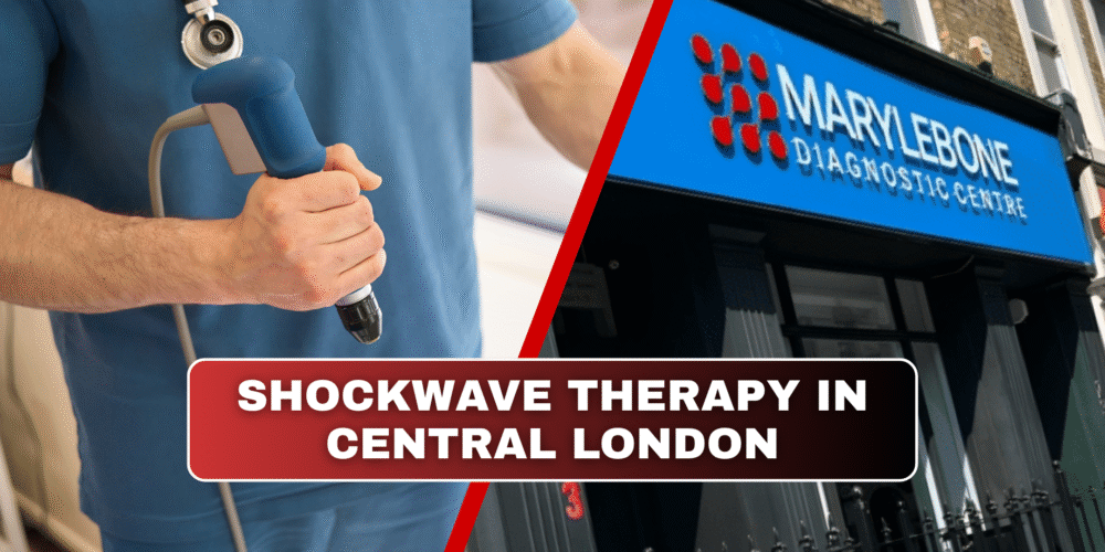 Book Your Shockwave therapy in London at Marylebone Diagnostic centre Today!