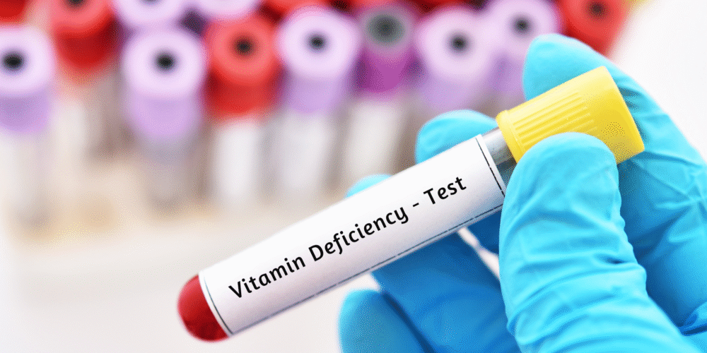 Book Your Vitamin Deficiency Test in London Today