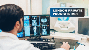 Private Prostate MRI London – Fast Appointments & PSA Tests at MDC Baker Street