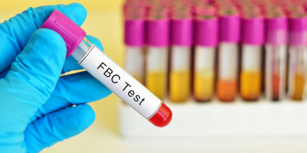 Book FBC Test in London Today!
