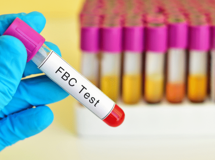 Book FBC Test in London Today!