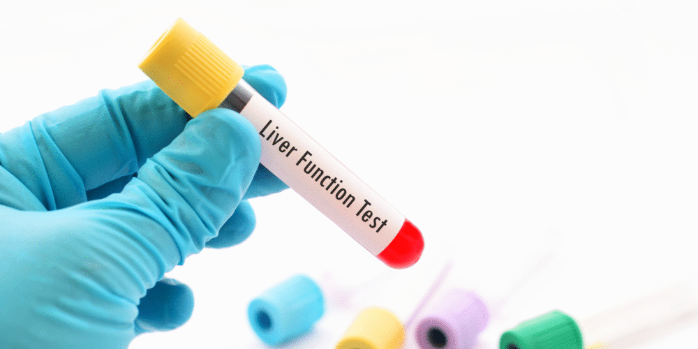 Book Liver Function Test in London Today!
