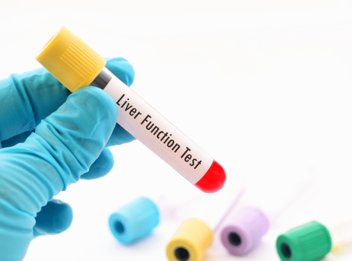Book Liver Function Test in London Today!