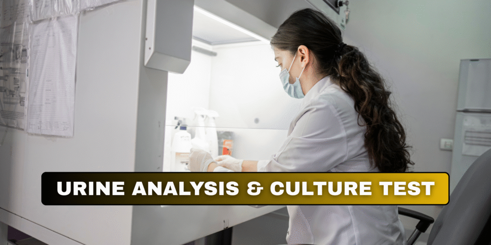 Book Urine Analysis & Culture Test in London Today!