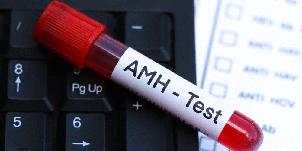 Book your AMH Test in London Today at Marylebone Diagnostic Centre
