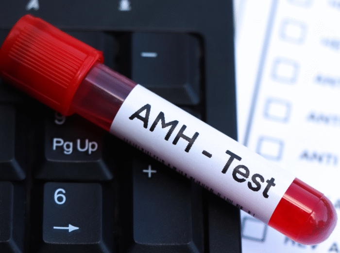 Book your AMH Test in London Today at Marylebone Diagnostic Centre