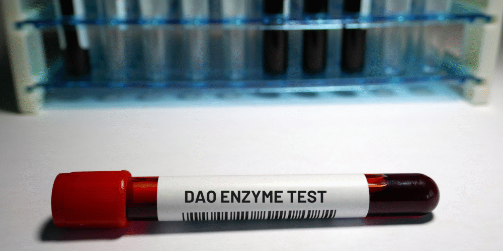 Book your DAO enzyme Test in London Today at Marylebone Diagnostic Centre