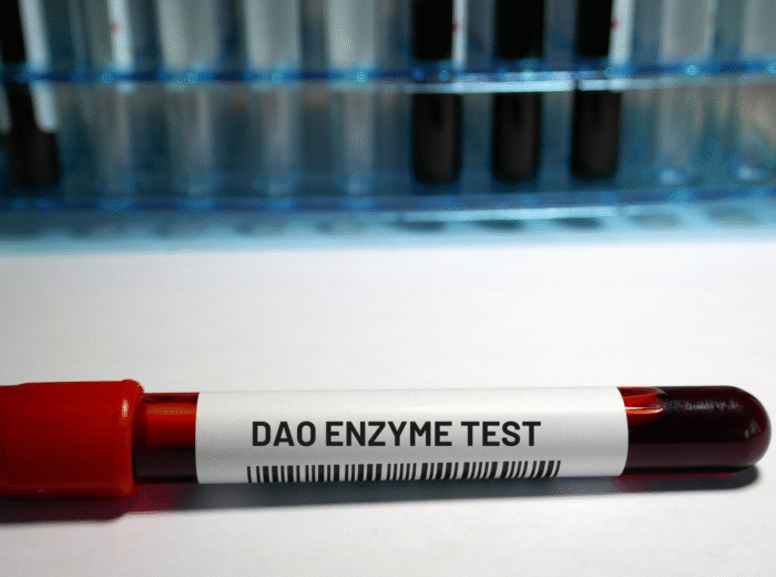 Book your DAO enzyme Test in London Today at Marylebone Diagnostic Centre