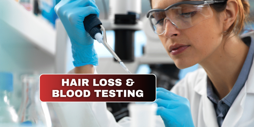 Hair Loss and Blood Testing - What Can Your Results Reveal