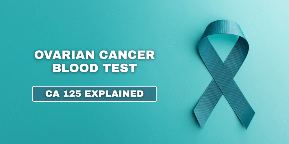 Ovarian Cancer Blood Test CA 125 Explained