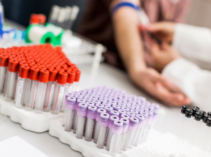 blood tests near me