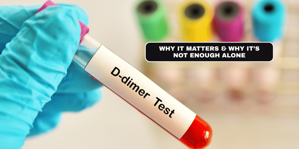 Book your D-dimer test in London Today! Why It Matters & Why It’s Not Enough Alone
