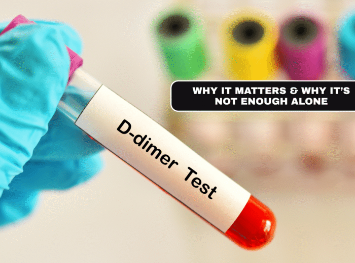 Book your D-dimer test in London Today! Why It Matters & Why It’s Not Enough Alone