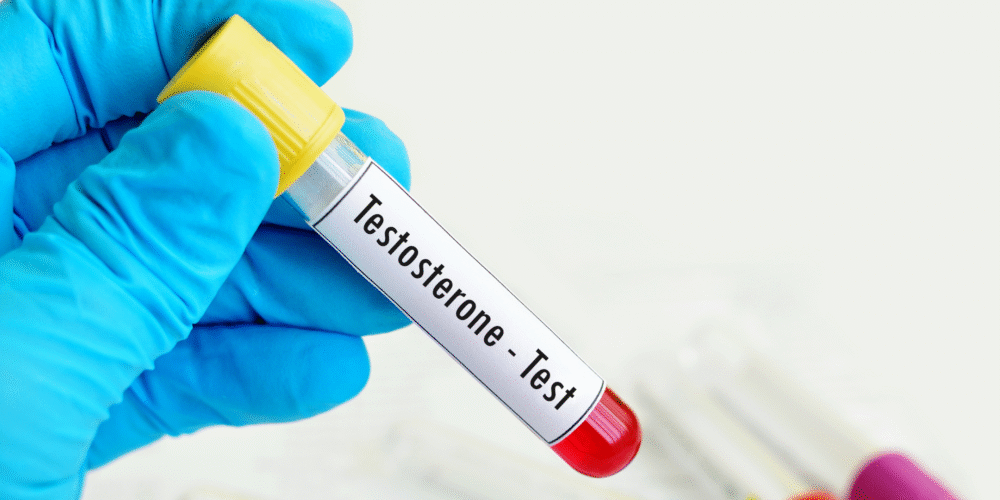 Book your Testosterone test in London Today! Why It Matters & Why It’s Not Enough Alone