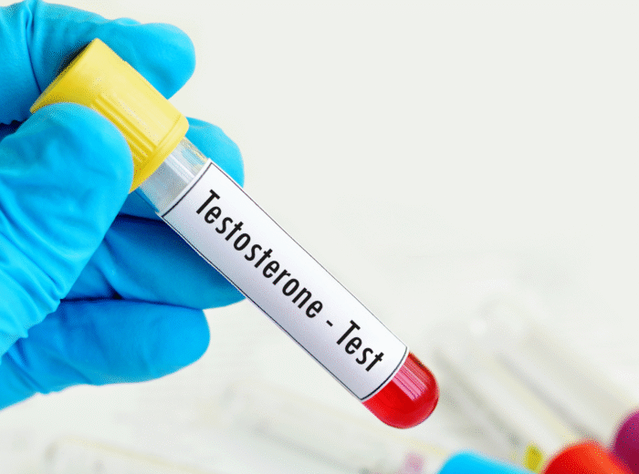 Book your Testosterone test in London Today! Why It Matters & Why It’s Not Enough Alone