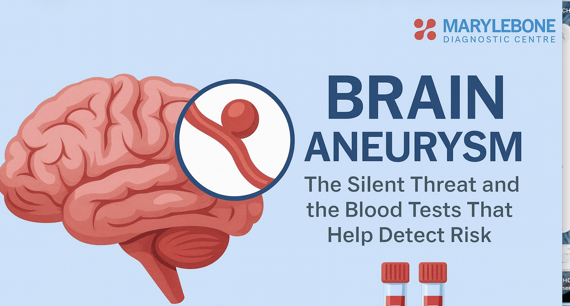 Brain Aneurysm: The Silent Threat and the Blood Tests That Help Detect Risk