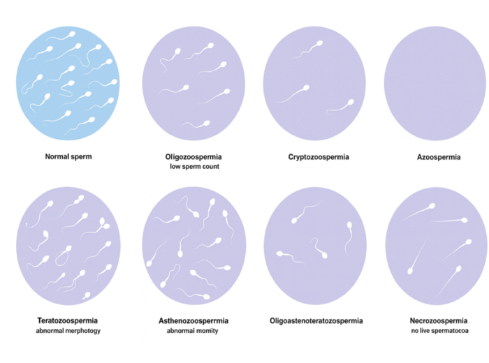 Semen Analysis - Purpose, Procedure, and Results