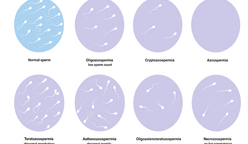 Semen Analysis - Purpose, Procedure, and Results