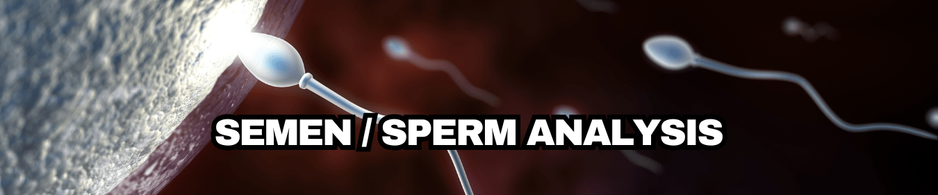 Semen sperm analysis London
