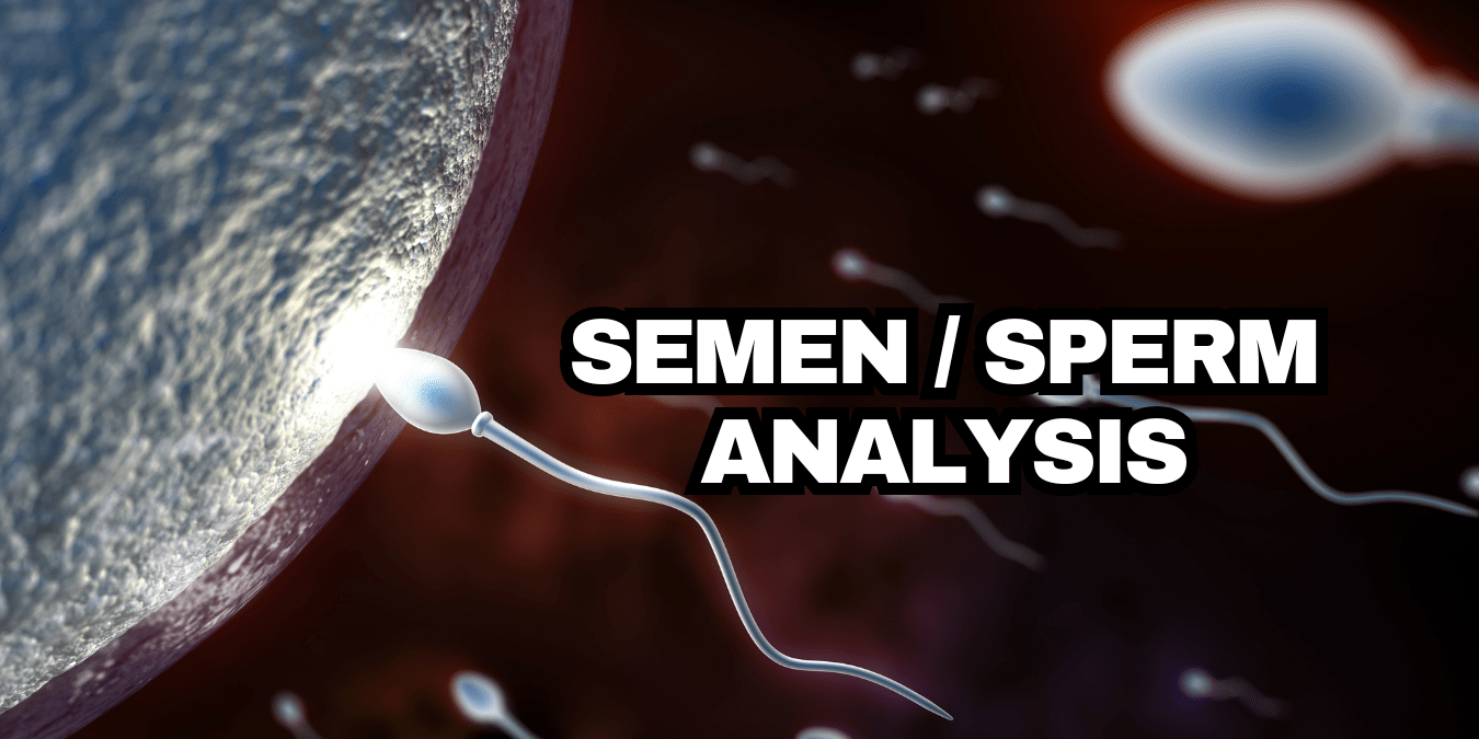 Semen sperm analysis in London