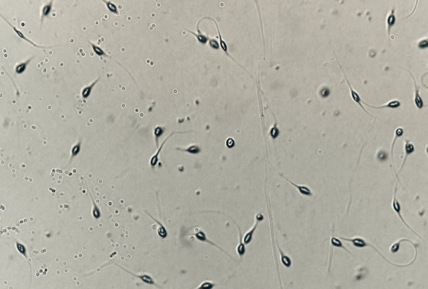 sperm count test at marylebone diagnostic centre
