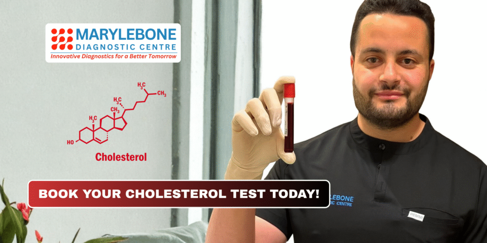 Book Your Cholesterol Test Today!