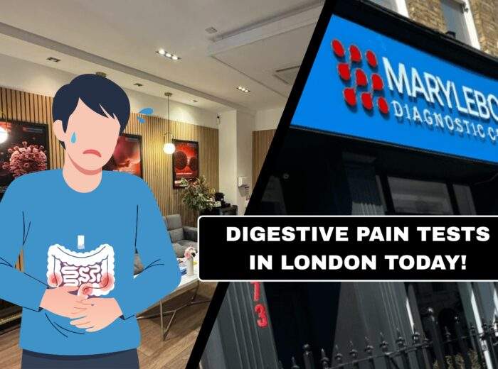 Book Your Digestive Pain Tests in London Today What Tests You Need at Marylebone Diagnostic Centre