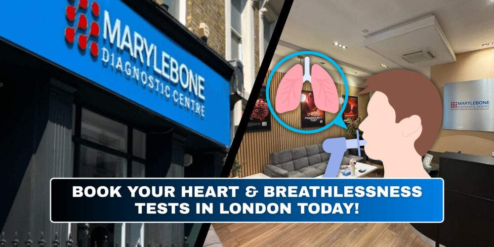 Book Your Heart & Breathlessness Tests in London Today What Tests You Need at Marylebone Diagnostic Centre