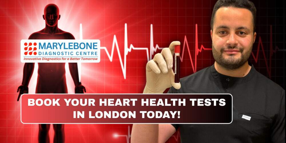 Book Your Heart Health Tests in London Today at Marylebone Diagnostic Centre