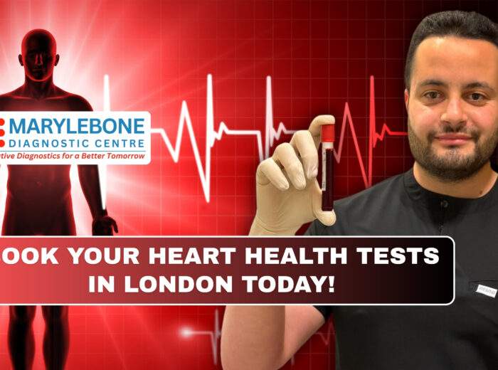 Book Your Heart Health Tests in London Today at Marylebone Diagnostic Centre