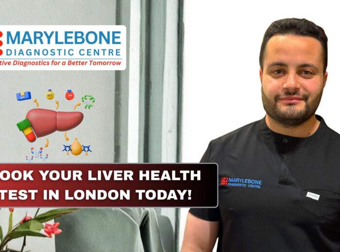Book Your Liver Health Test in London Today!