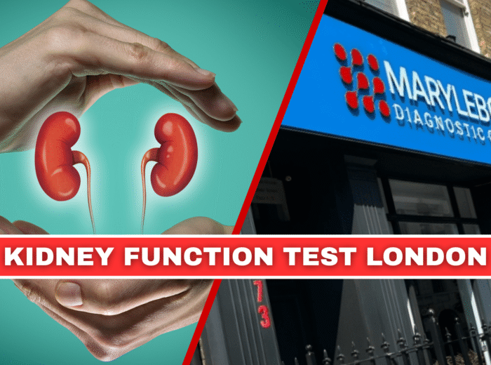 Book Your kidney function test in London Today!