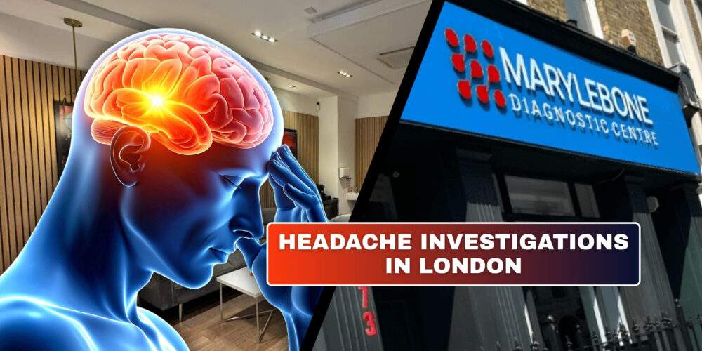 Headache Investigations in London What Tests You Need at Marylebone Diagnostic Centre