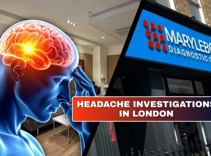 Headache Investigations in London What Tests You Need at Marylebone Diagnostic Centre