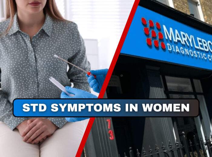 STD Symptoms in Women Book Your Private STD Test in London Today!