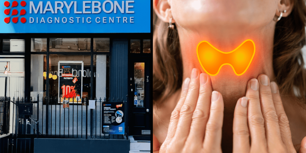 Book Your Advanced Thyroid Testing in London Today What Tests You Need at Marylebone Diagnostic Centre