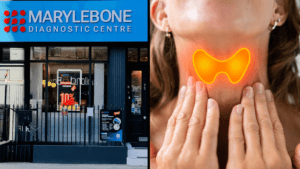Book Your Advanced Thyroid Testing in London Today What Tests You Need at Marylebone Diagnostic Centre