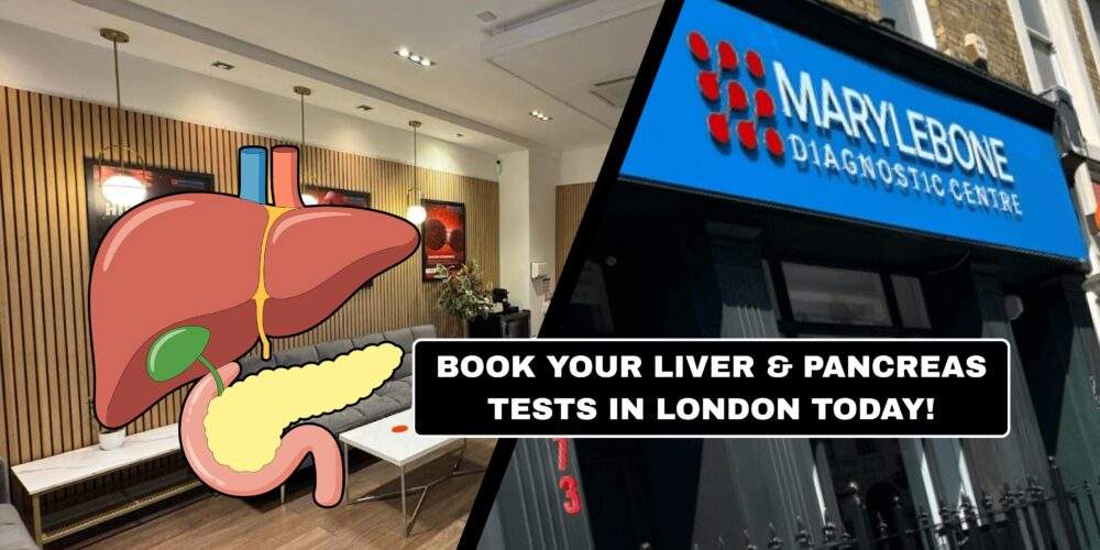 Book Your Liver and Pancreas Tests What Tests You Need at Marylebone Diagnostic Centre
