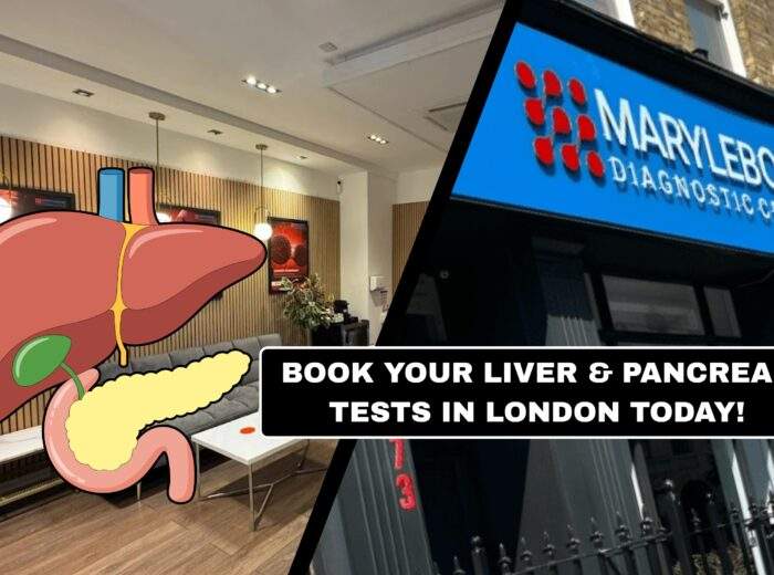 Book Your Liver and Pancreas Tests What Tests You Need at Marylebone Diagnostic Centre