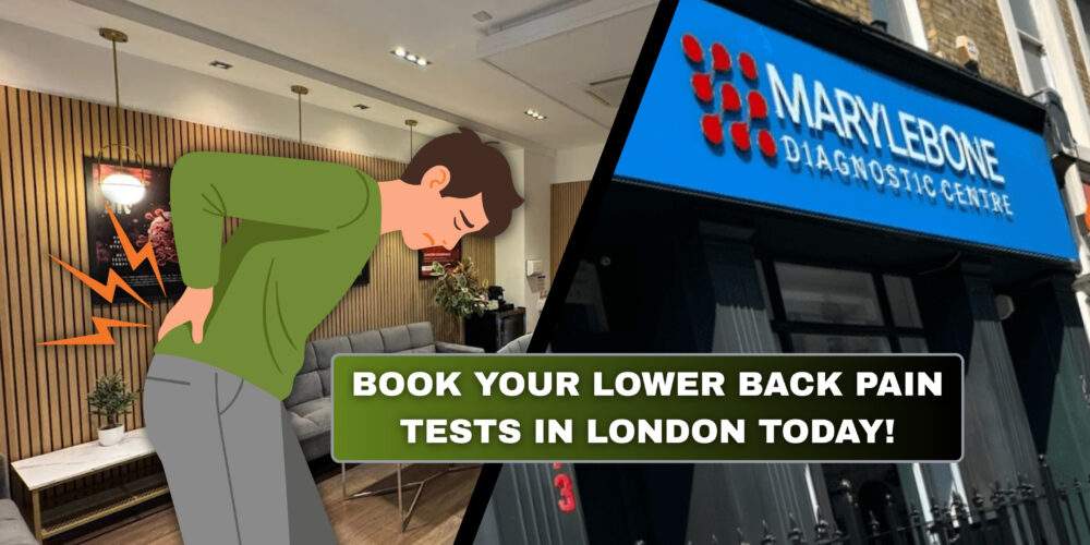 Book Your Lower Back Pain Tests in London Today What Tests You Need at Marylebone Diagnostic Centre