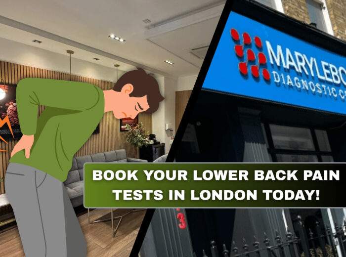 Book Your Lower Back Pain Tests in London Today What Tests You Need at Marylebone Diagnostic Centre